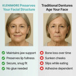 Fomonest Adaptive Denture System
