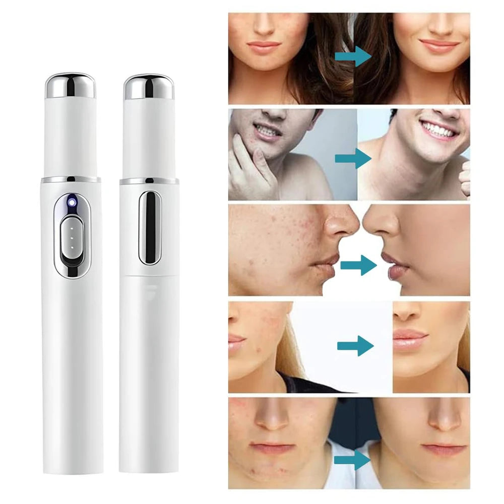 ClearSkin Home Laser Pen