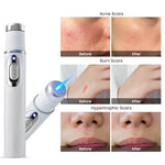 ClearSkin Home Laser Pen