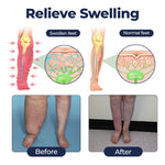 SwellRelief Circulation Cream