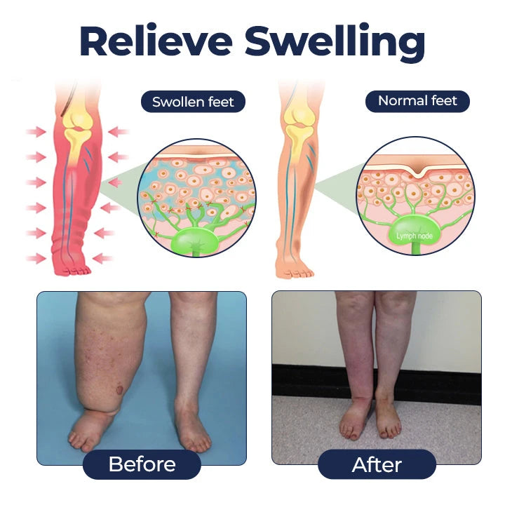 SwellRelief Circulation Cream