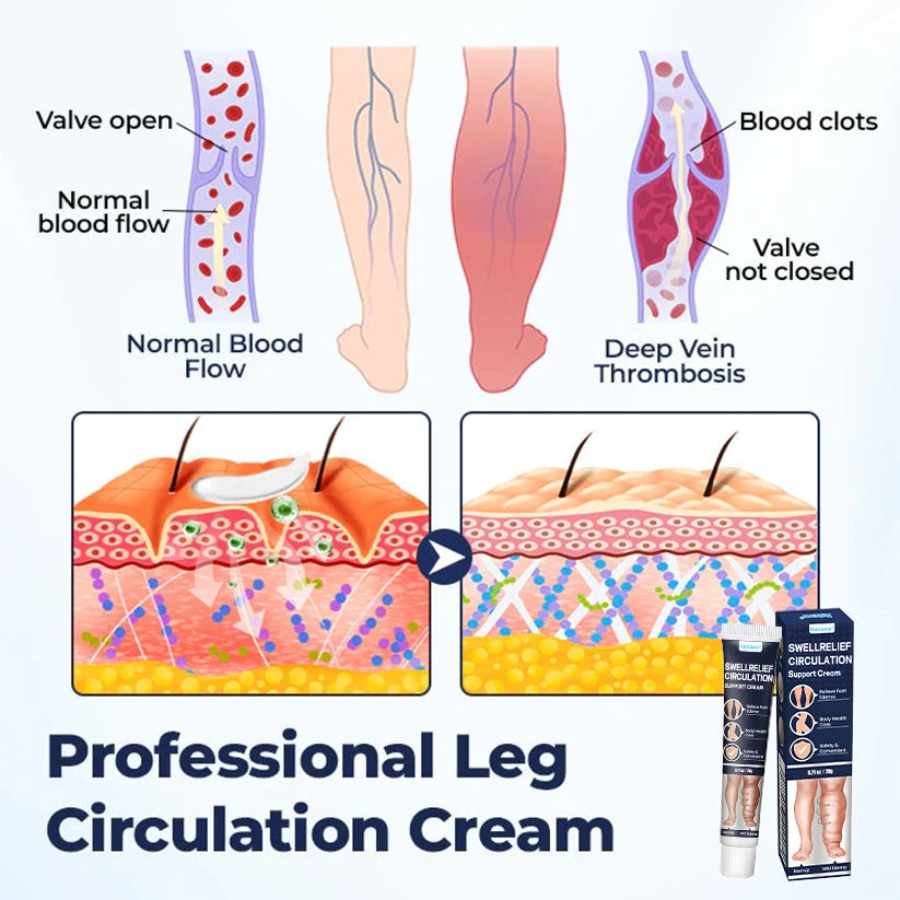 SwellRelief Circulation Cream