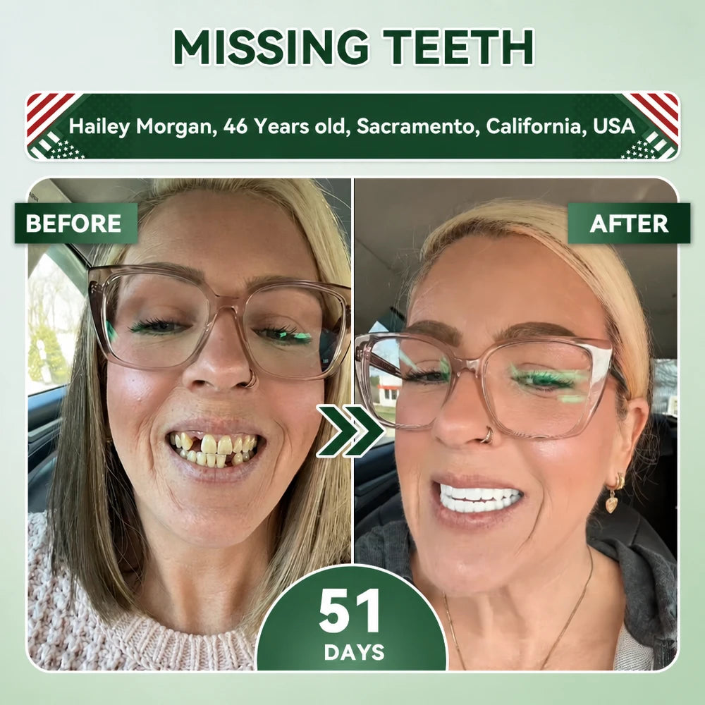 SmileRenew Dental Repair Strips