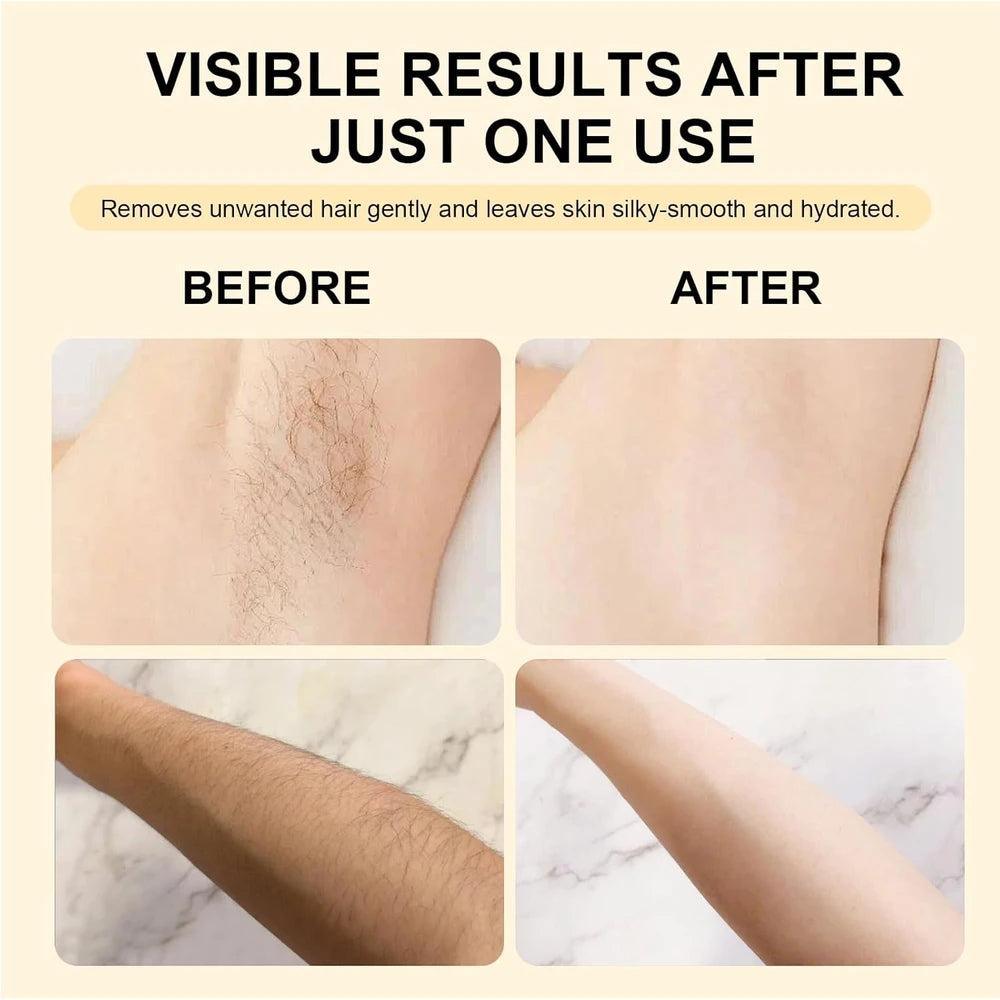 Umex Sensitive Skin Hair Removal Cream