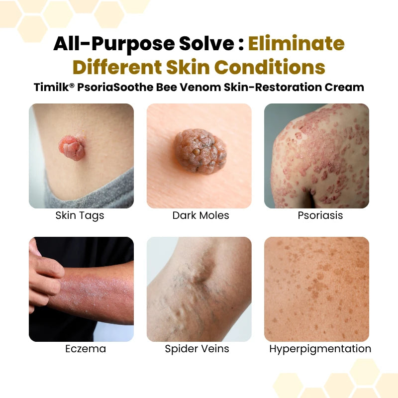 Bee Venom Skin  Rescue Cream