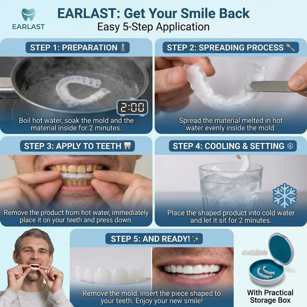 InstaSmile Pro Cosmetic Veneers