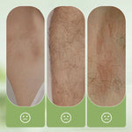 Gentle Hair Removal Cream