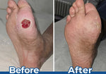 Ceoerty PureFoot Repair Stick