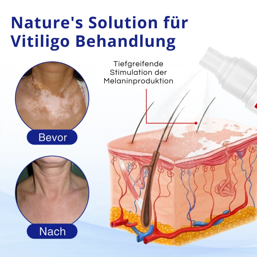 Plant-Based Skin Restore Spray