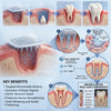 Tooth and Gum Repair Microneedle Patch