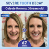 Tooth and Gum Repair Microneedle Patch