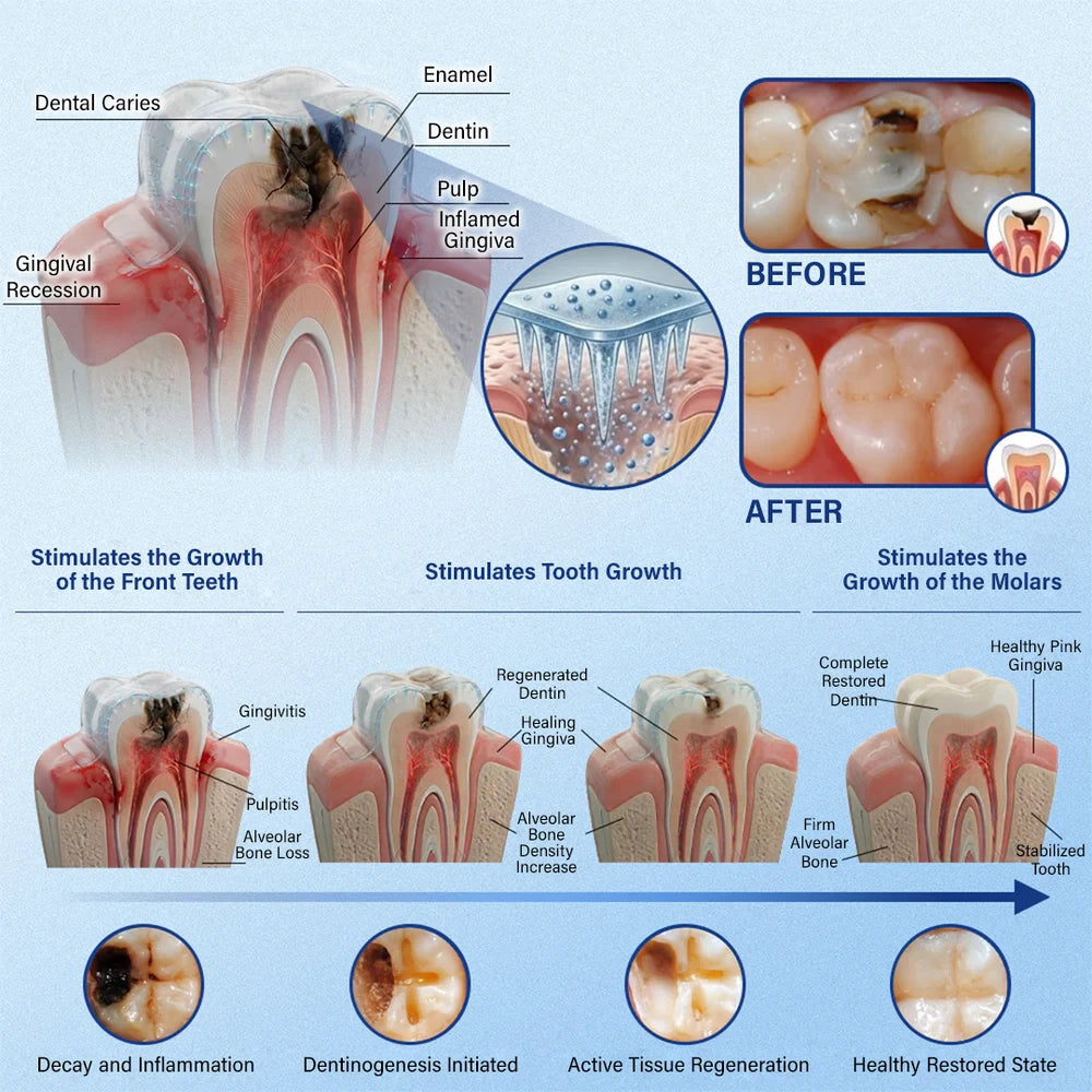 Tooth and Gum Repair Microneedle Patch