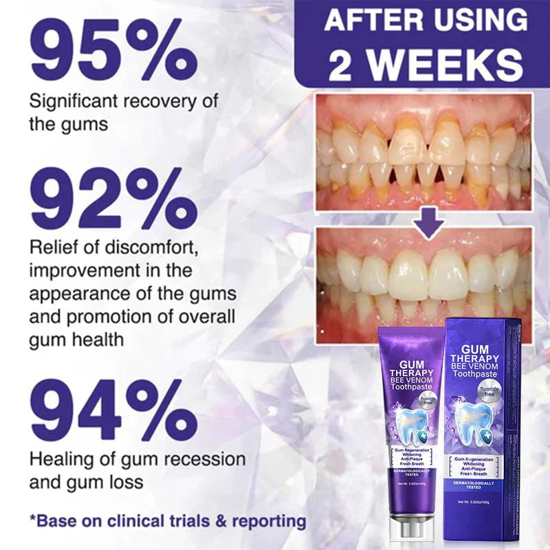 Bee Venom Toothpaste for Sensitive Gums
