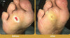 GlucaVeil 24H Foot Spray