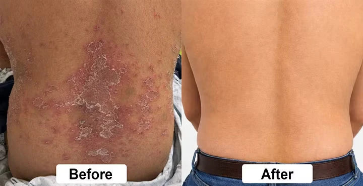 Beef Tallow Itch Relief Spray