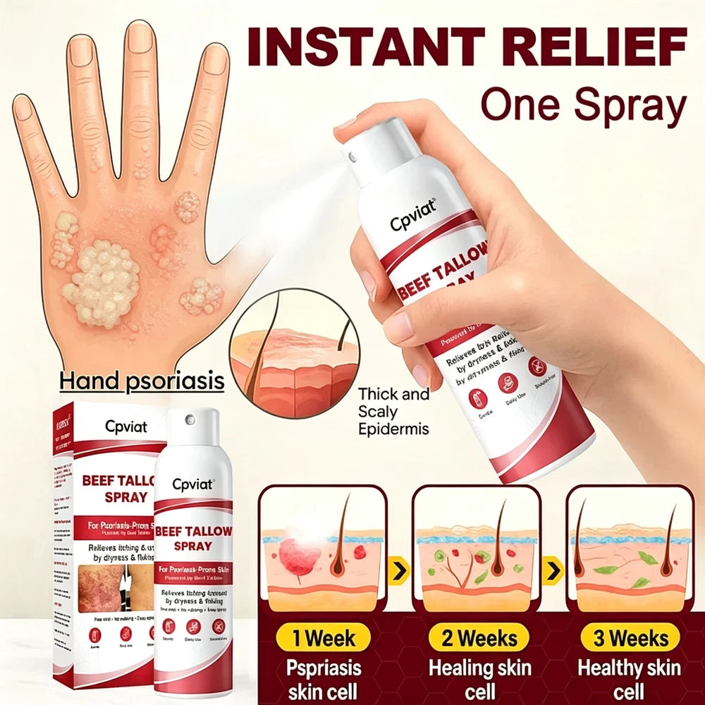 Beef Tallow Itch Relief Spray