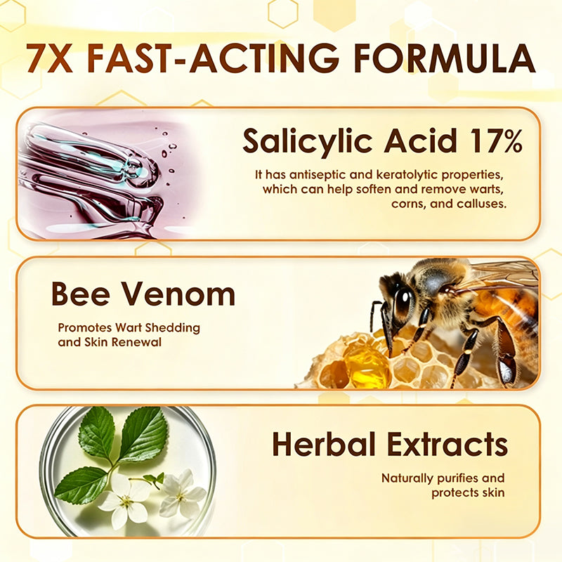 Bee Venom Corn and Callus Removal Cream | Soft Heels for Sandals